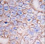 MAPK15 / ERK7 Antibody (aa32-61)