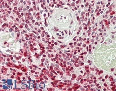 IHC-plus™ BATF2 / SARI Antibody (C-Terminus)