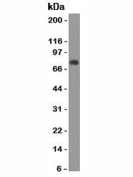 CEA / Carcinoembryonic Antigen Antibody (clone SPM584)