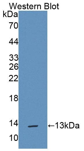 TFF1 / pS2 Antibody (aa1-81)