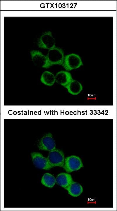 Polyclonal Rabbit anti-Human BBOX1 / BBOX Antibody (aa1-293, IHC, WB)