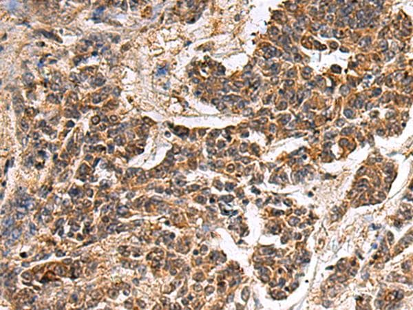 Polyclonal Rabbit anti-Human GANAB / Alpha Glucosidase II Antibody (IHC)