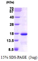 Human EIF1 Protein (Recombinant His)