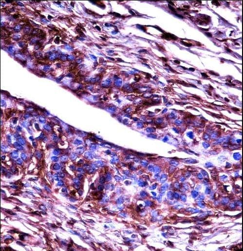 ADRBK2 / GRK3 Antibody (aa524-552)