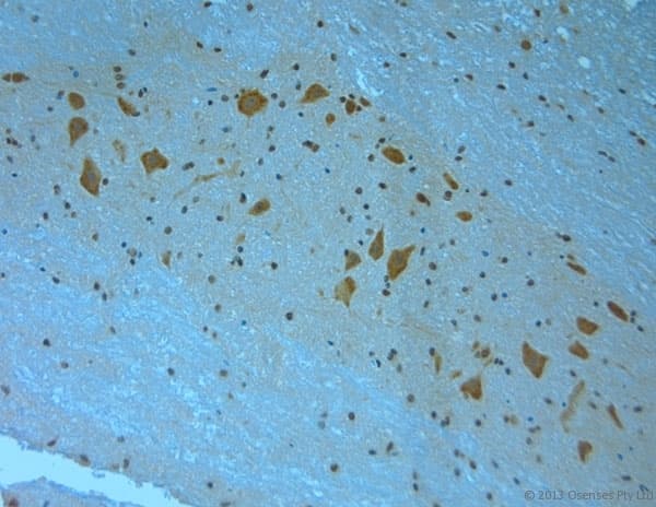 MPP4 / Discs Large Homolog 6 Antibody (aa590-635)