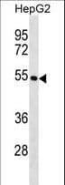 Polyclonal Rabbit anti-Human KRT26 / Keratin 26 Antibody (aa117-146, WB)