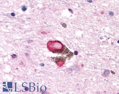 PathPlus™ HTR7 / 5HT7 Receptor Antibody (C-Terminus)