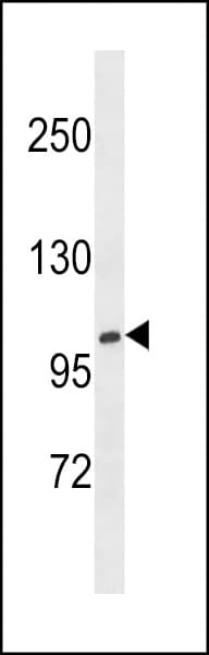 Polyclonal Rabbit anti-Human XYLT1 / XylT-I Antibody (aa126-155, WB)