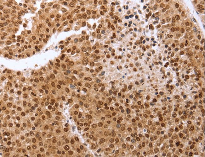Polyclonal Rabbit anti-Human Securin / PTTG1 Antibody (IHC)