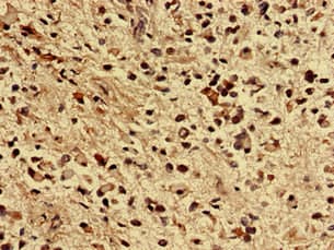 Polyclonal Rabbit anti-Human ZNF529 Antibody (WB)