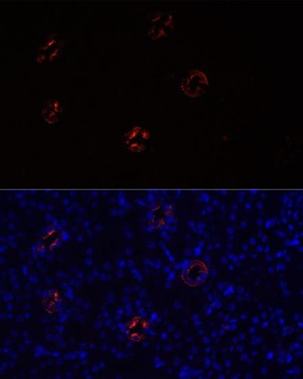 AQP2 / Aquaporin 2 Antibody