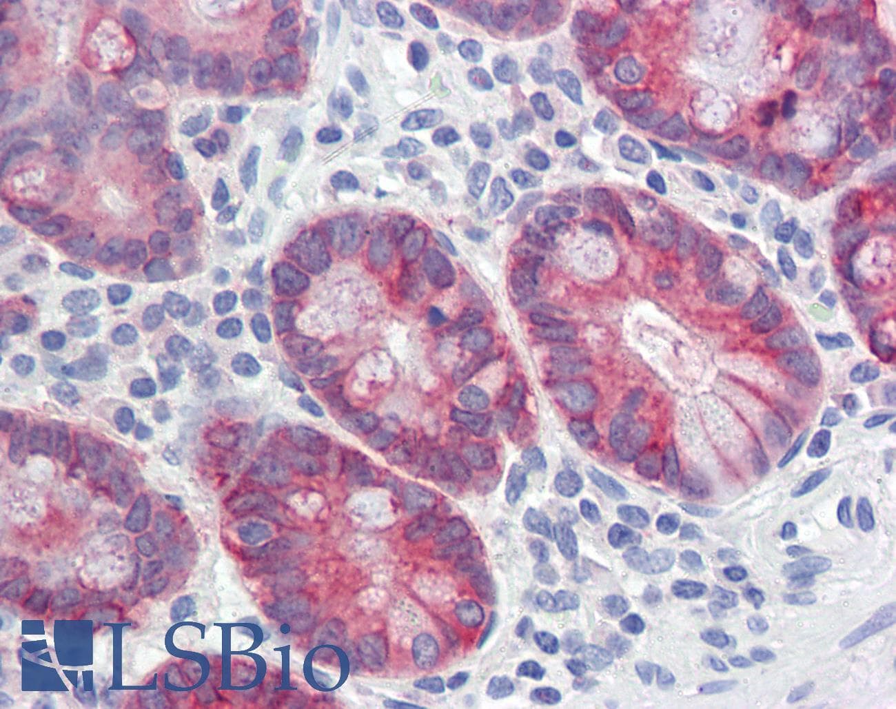 IHC-plus™ AGR2 Antibody (aa48-59)
