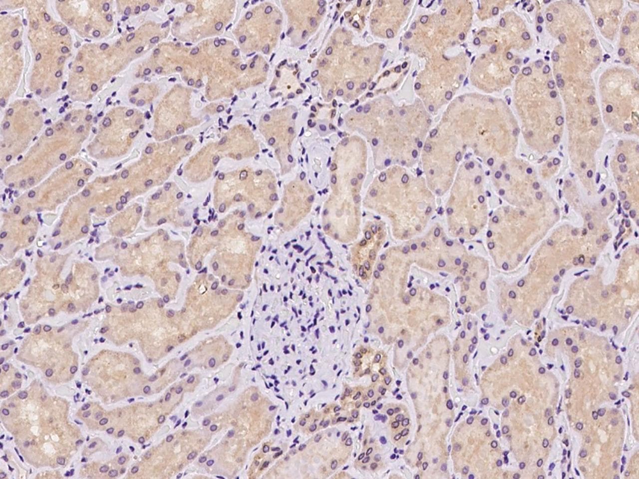 TNIP3 Antibody
