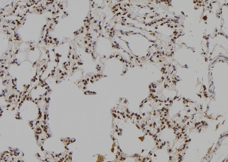 LHX8 Antibody