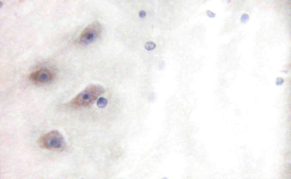 DPYSL2 / CRMP2 Antibody (phospho-Thr514)