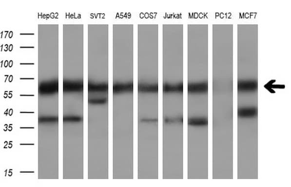 CLU / Clusterin Antibody (aa23-227, clone OTI2A7)