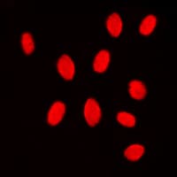 Polyclonal Rabbit anti-Human MEK3/6 Antibody (Internal, IHC, IF, WB)