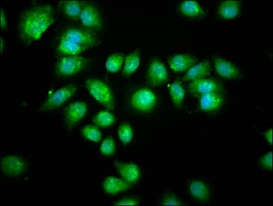 AANAT Antibody