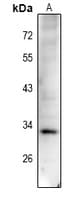 CCND1 / Cyclin D1 Antibody