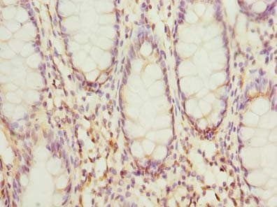 HSDL2 Antibody