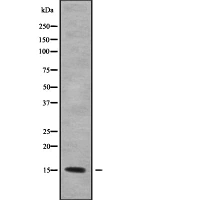 KCNE5 Antibody