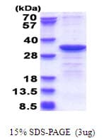 Human CYB5R2 Protein (Recombinant His)