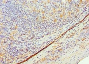 Polyclonal Rabbit anti-Human TK1 / TK / Thymidine Kinase Antibody (aa1-234, IHC)