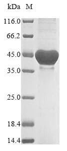 Neisseria meningitidis nadA Protein (Recombinant 6His, N-terminus)