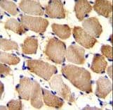 ARL17A Antibody (aa102-130)
