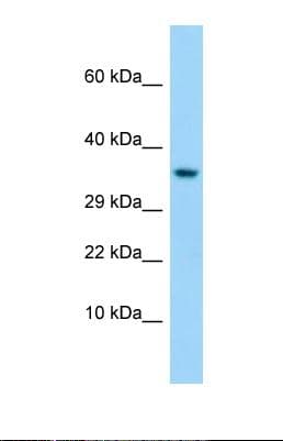 T1R1 / TAS1R1 Antibody (aa223-272)