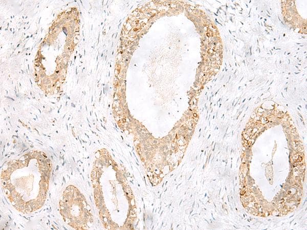 TOR1A / Torsin A Antibody