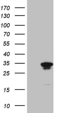 GTPCH1 / GCH1 Antibody (clone OTI1E3)