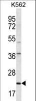 HLA-DQA1 Antibody (aa57-84)