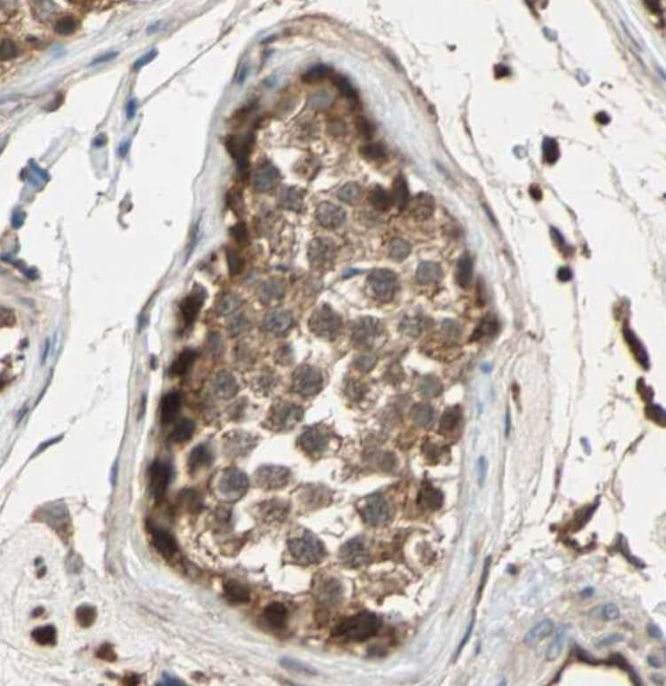 MAPK3 / ERK1 Antibody (phospho-Tyr204,pThr202)