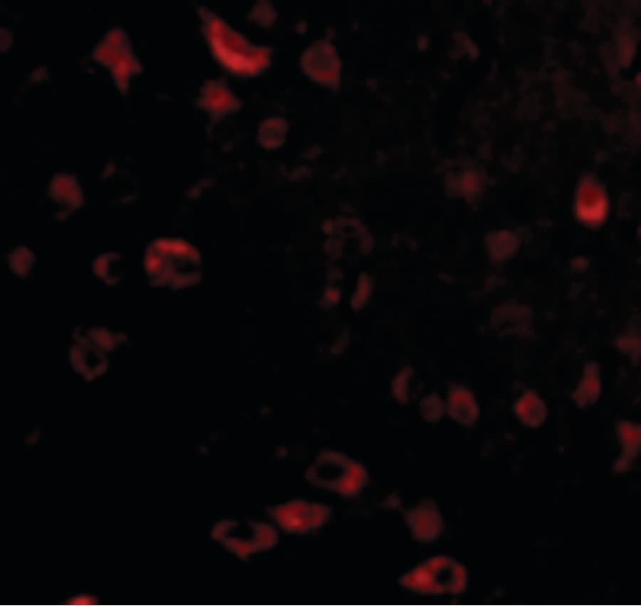 IHC-plus™ TIGAR Antibody