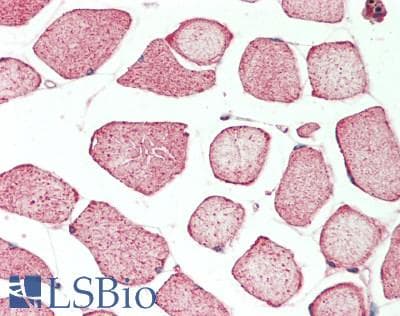 IHC-plus™ MLXIP / MONDOA Antibody