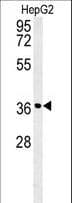 CCND1 / Cyclin D1 Antibody (aa203-238)