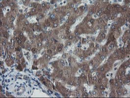 SKIL / SNO / SnoN Antibody (clone OTI1A6)