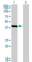 Monoclonal Mouse anti-Human SMS / Spermine Synthase Antibody (clone 1G6, WB)