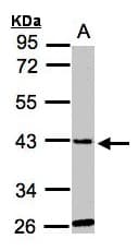 IHC-plus™ GLYATL1 Antibody (aa73-302)