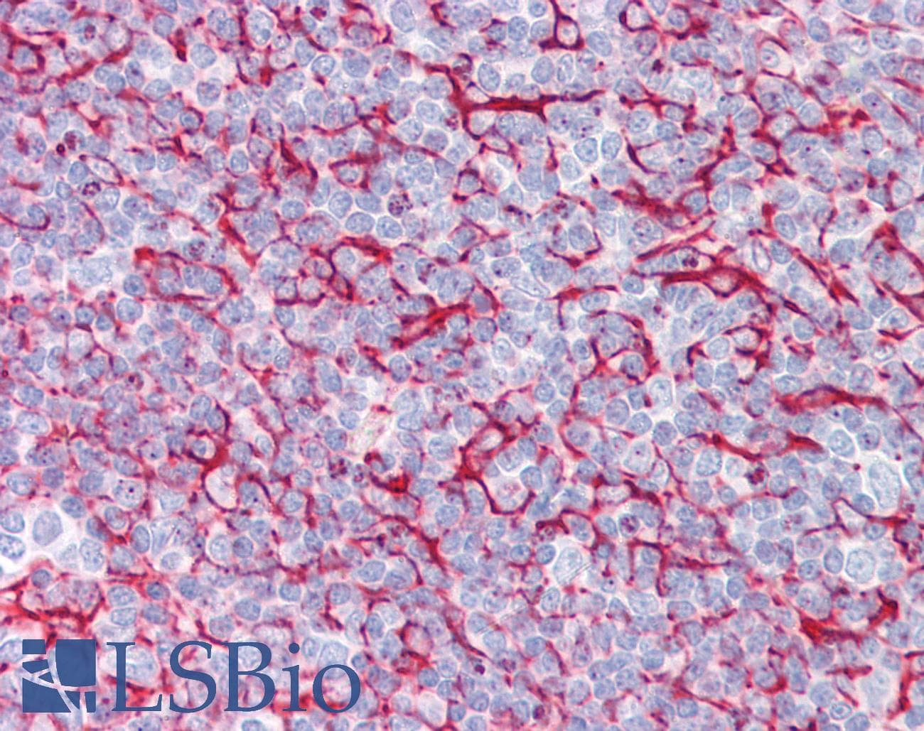 IHC-plus™ Polyclonal Rabbit anti-Human BRAF / B-Raf Antibody (aa411-460, IHC, WB)
