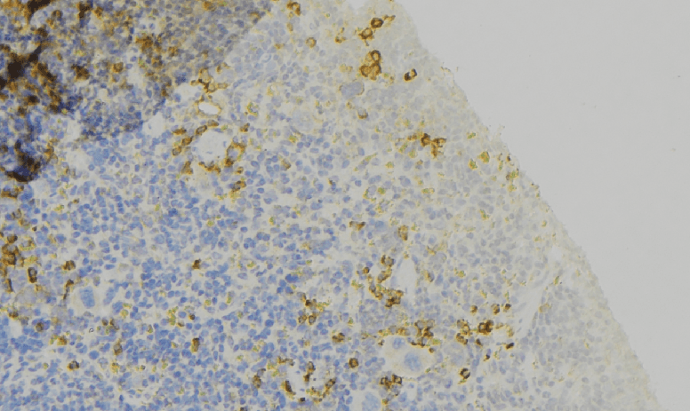 ATRN / Attractin Antibody
