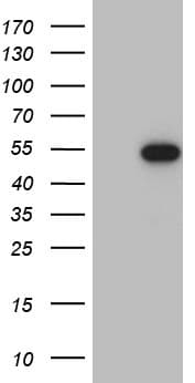 Monoclonal Mouse anti-Human RAX / RX Antibody (clone OTI5C10, Carrier-free, aa1-222, WB)