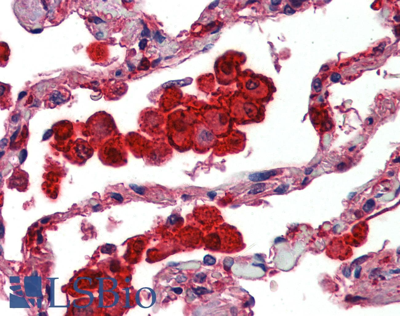 PathPlus™ Polyclonal Rabbit anti-Human CASP12 / Caspase 12 Antibody (IHC, IF, WB)