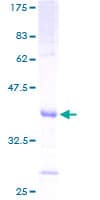 Human SLPI / Antileukoproteinase (Recombinant GST)