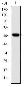 CCT2 / CCT Beta Antibody (clone 5B5F5)