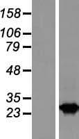 RAB2B Protein (Over-Expression Lysate Myc-DDK (Flag))