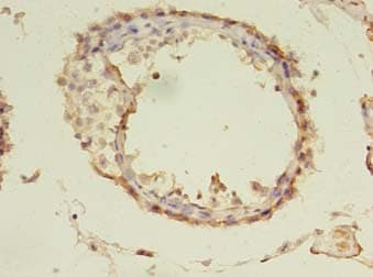 TUBA1A / Tubulin Alpha 1a Antibody