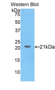 COL8A1 / Collagen VIII Alpha 1 Antibody (aa575-743, FITC)