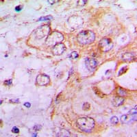 PFKFB2 Antibody (N-Terminus)